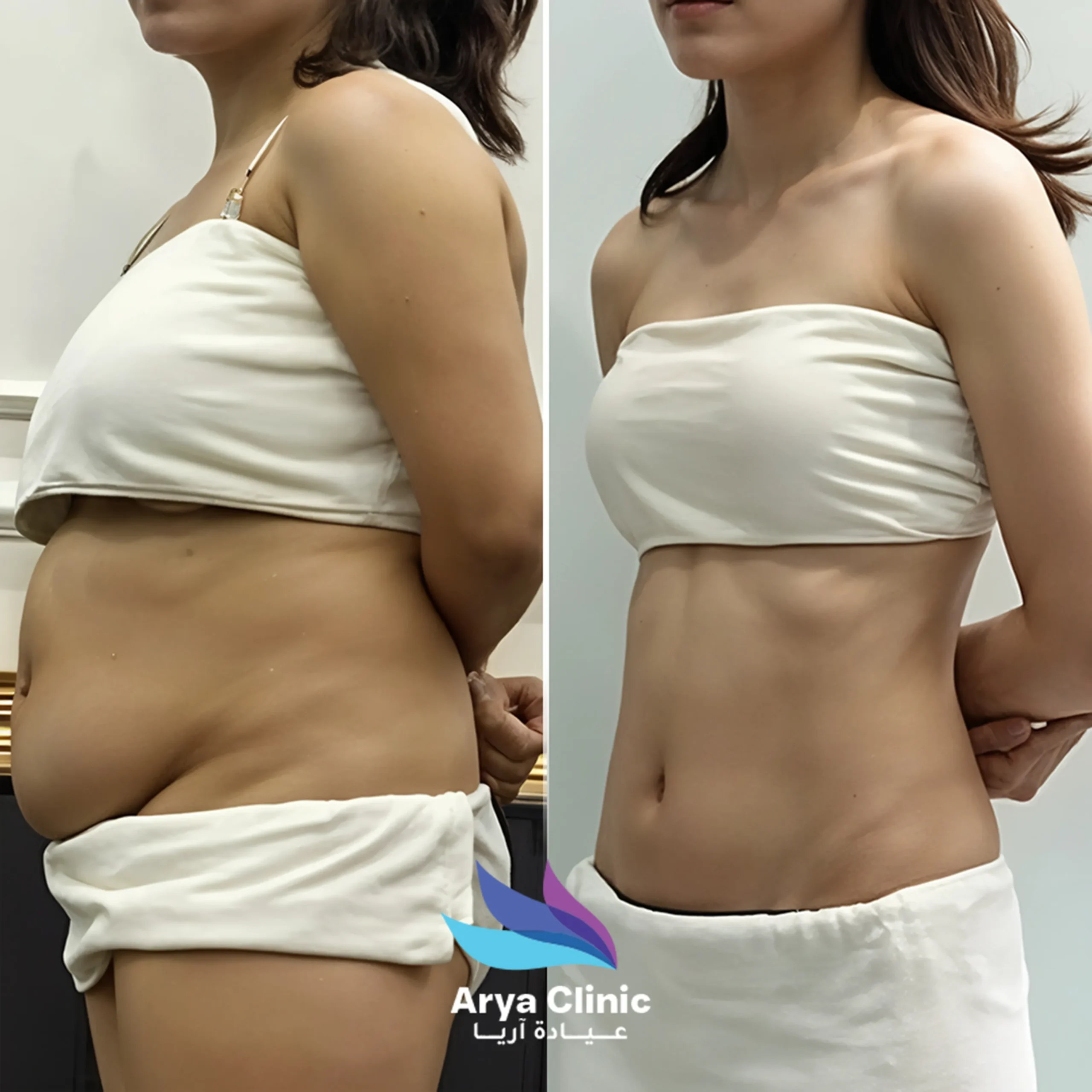 liposuction surgery cost